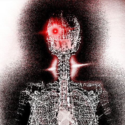 Cyanotic
